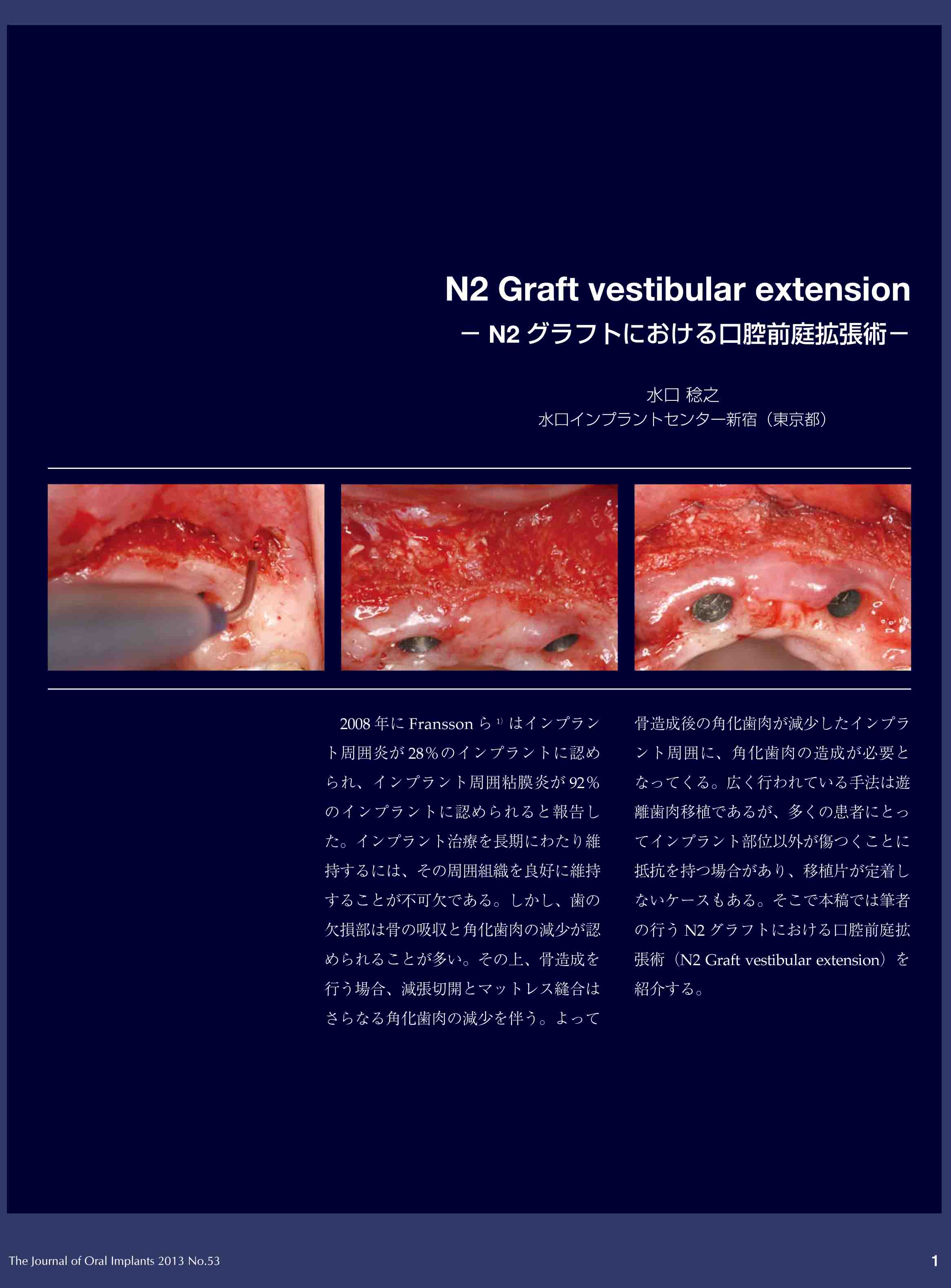 N2vestibular